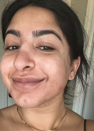 Month 6