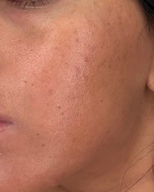 Month 3