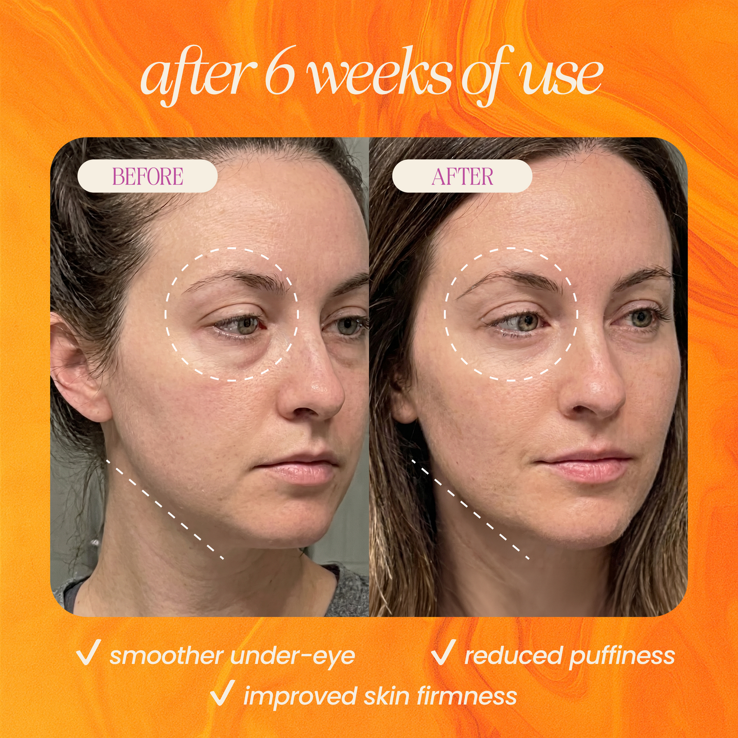 Face Sculpt Set for Lymphatic Drainage
