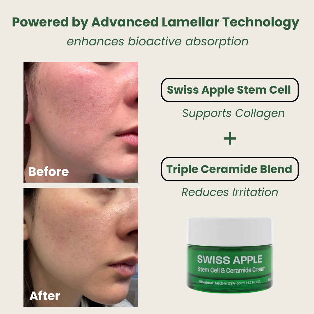 Swiss Apple Stem Cell & Ceramide Cream – Mudita Earth Swiss Apple Stem Cell & Ceramide Cream – Mudita Earth
